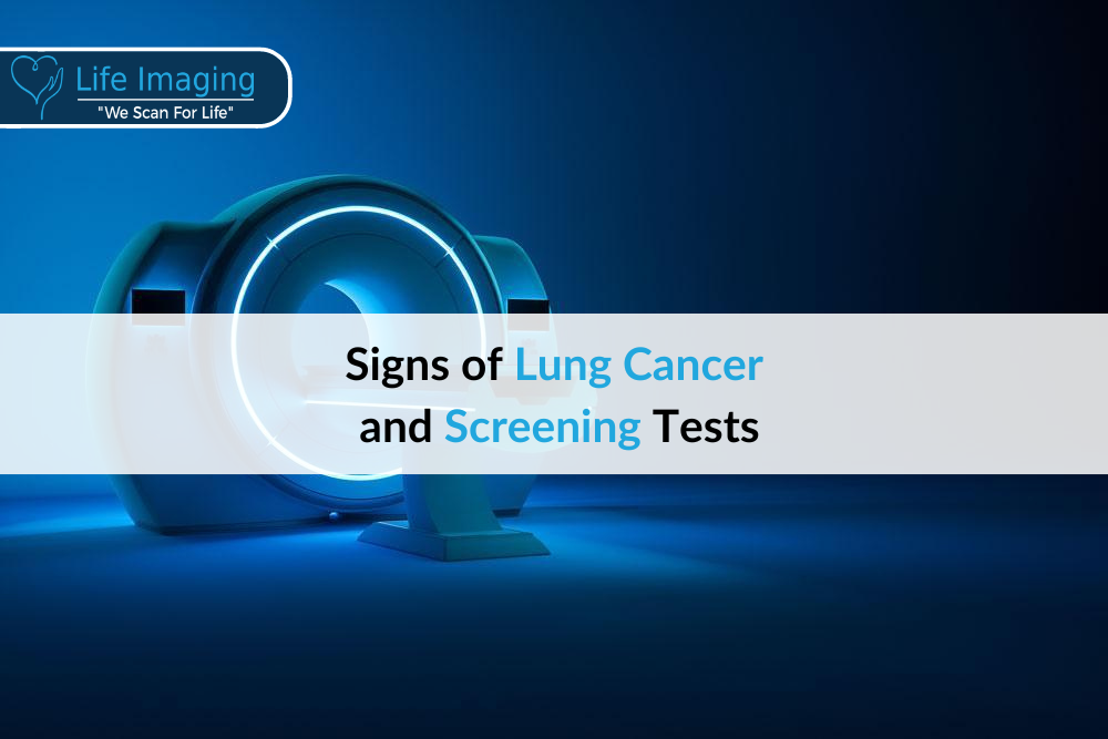 Lung cancer