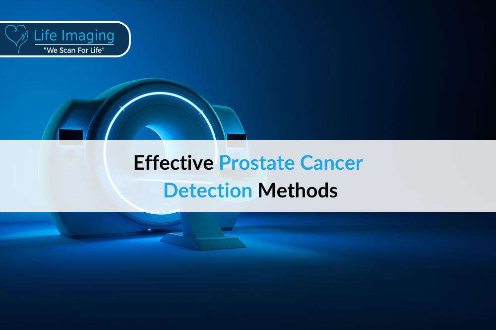 Prostate Cancer